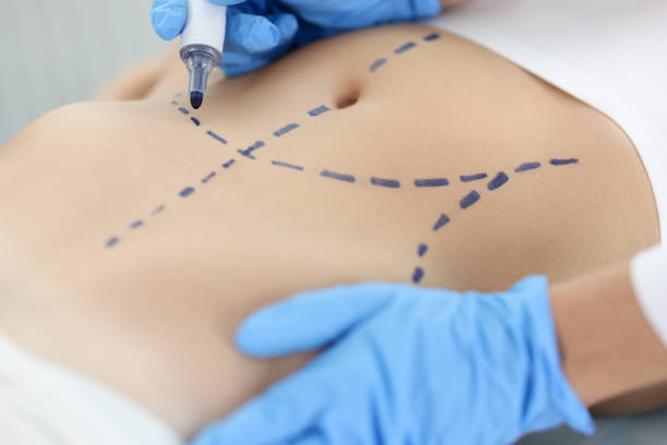 Cosmetic surgery 2 Chirurgie plastique